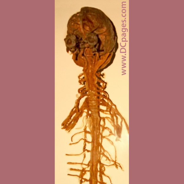 This central nervous system (CNS) specimen represents the largest part of the human nervous system, including the brain and the spinal cord. 